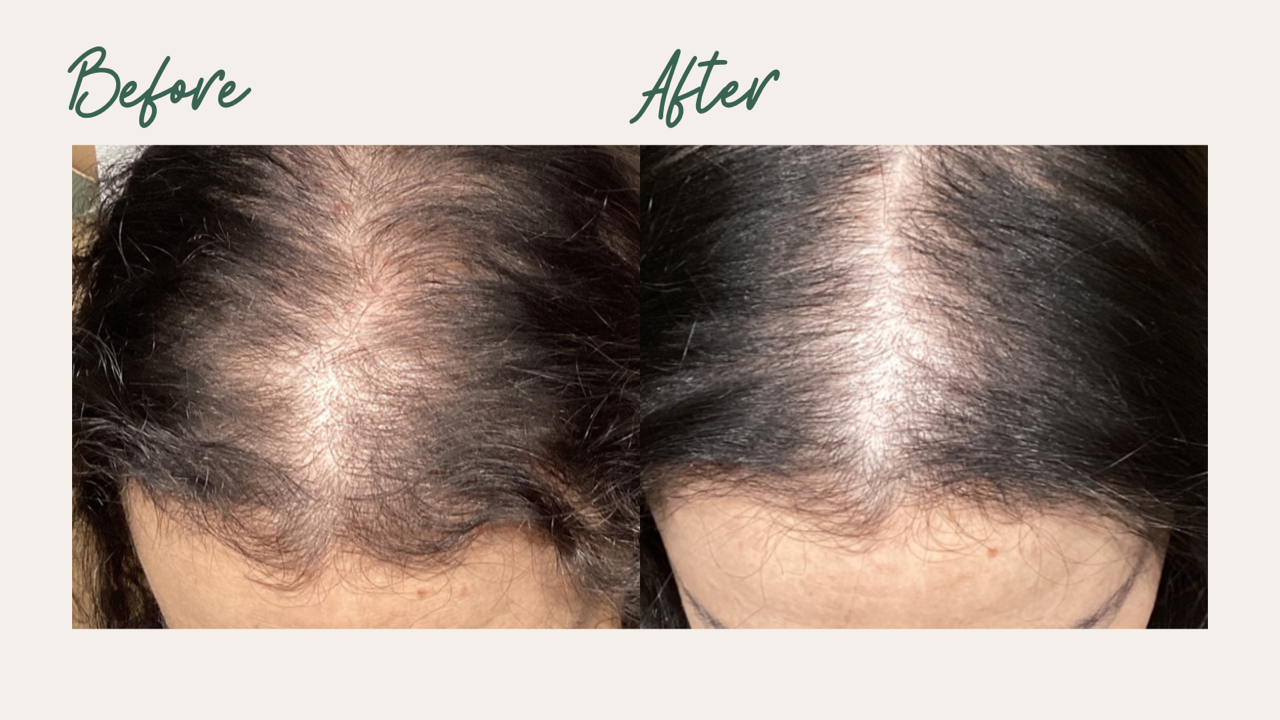 Increased Hair Density