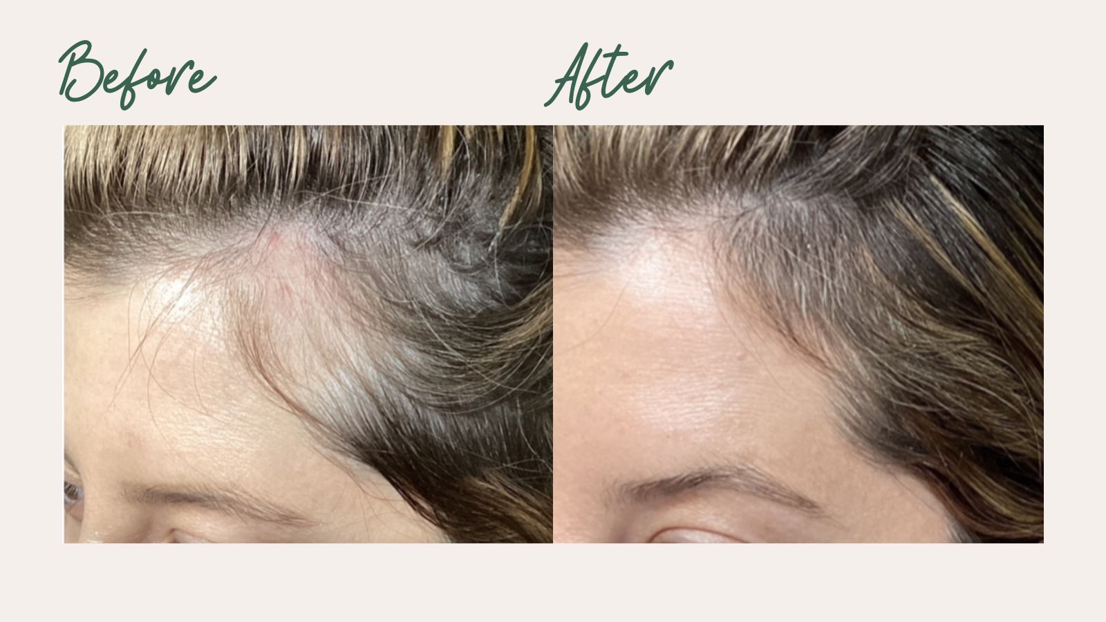 Improved Hair Thickness
